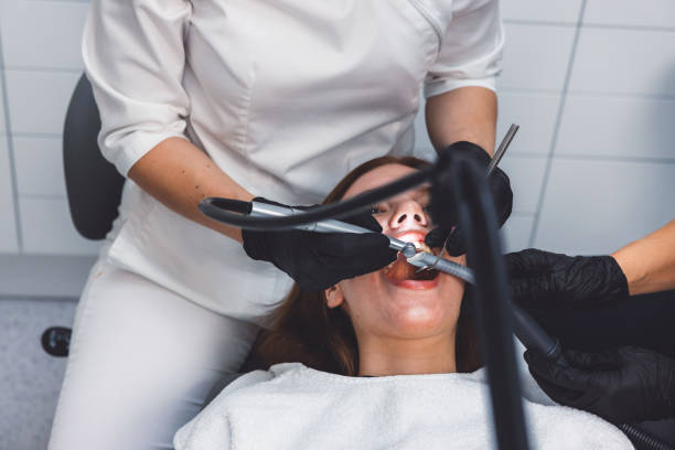 Best Emergency Wisdom Tooth Extraction in USA
